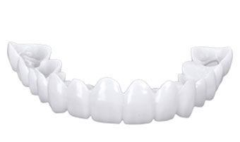 Snap-On Smile виниры